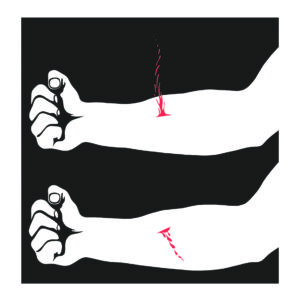 FONTÄÄN